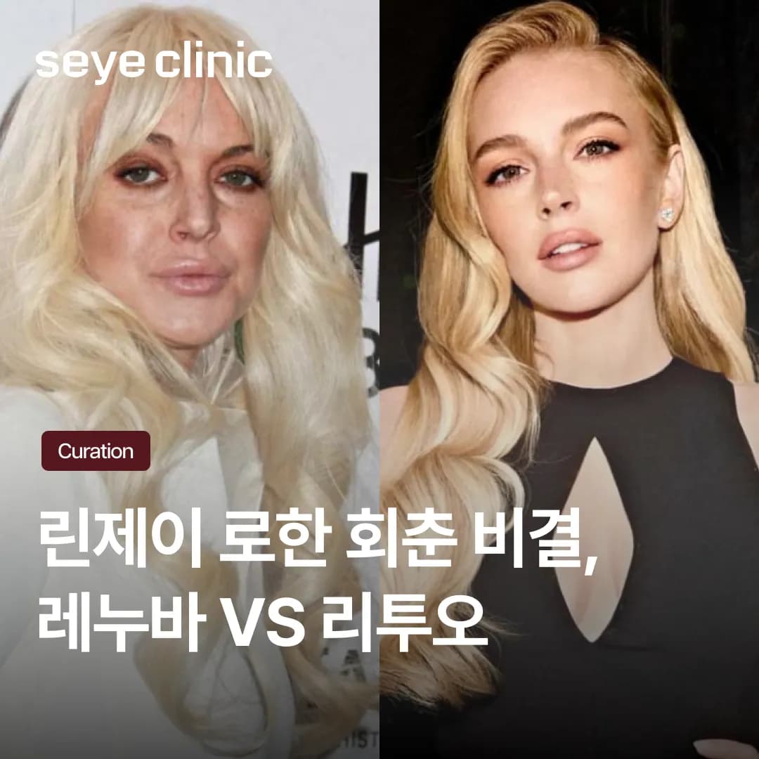 린제이 로한이 선택한 레누바? 국내 시술 불가한 이유와 대안책 리투오 효과