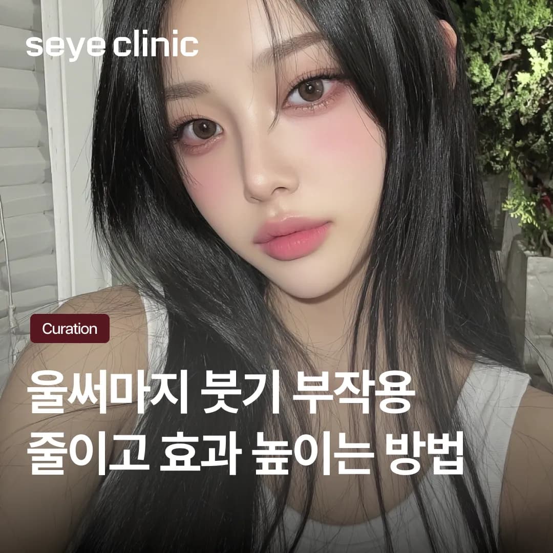울써마지 붓기, 언제 빠질까요? 중요한 일정 앞두고 회복 기간 줄이는 노하우