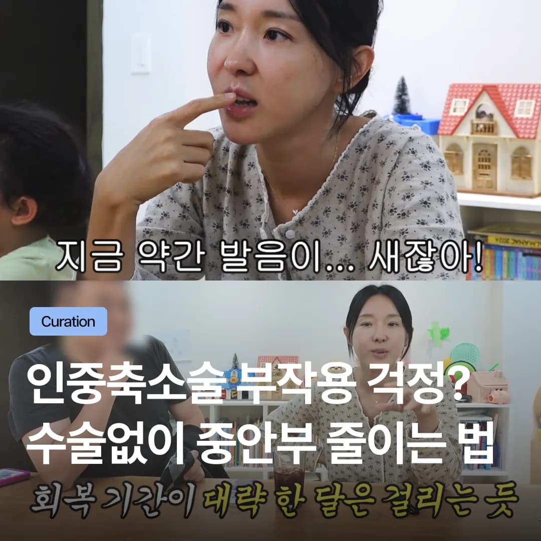 이지혜가 후회한 인중축소술 부작용? 수술 없이 중안부 줄이는 피부과 시술 알아보기