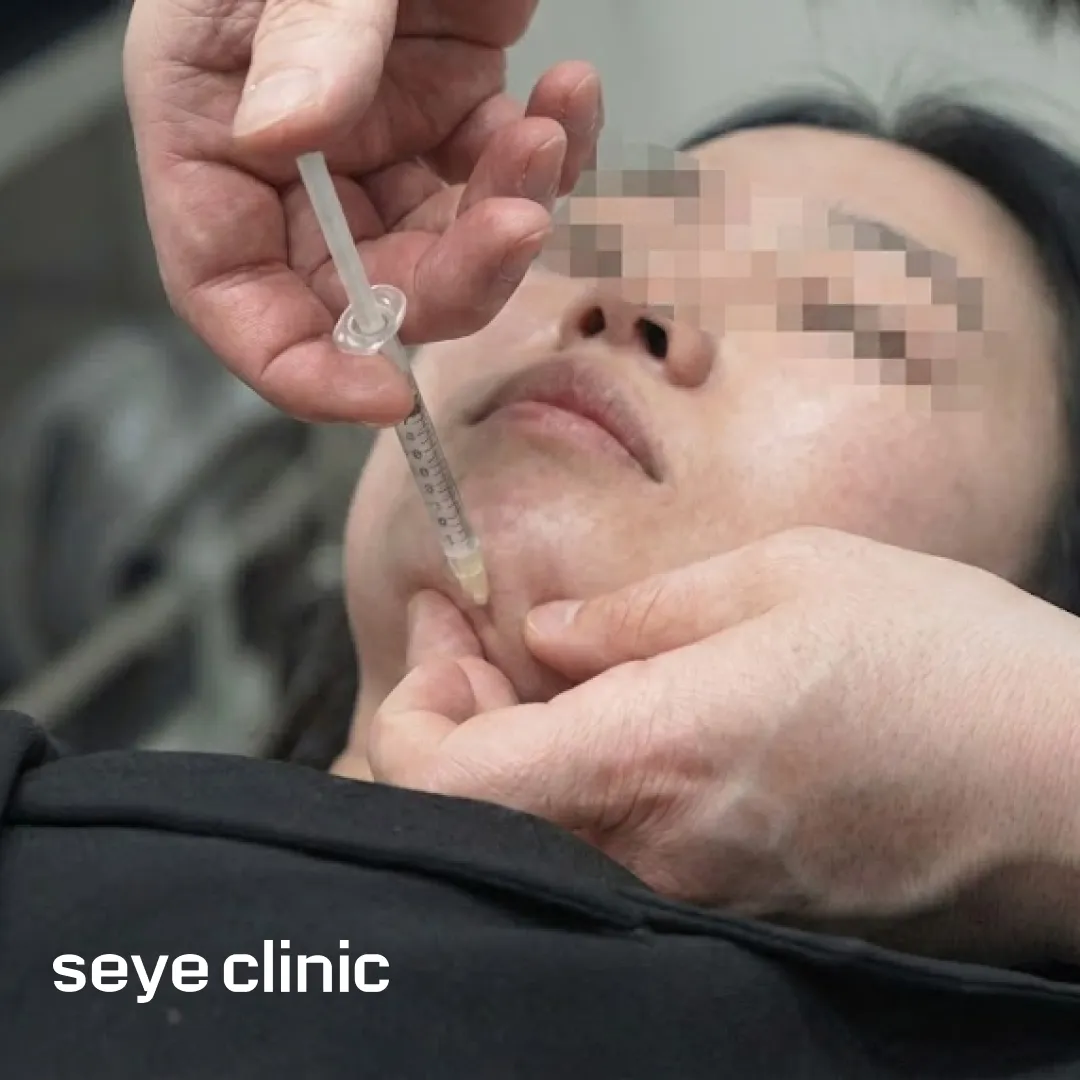 나이테주사 이중턱주사.webp