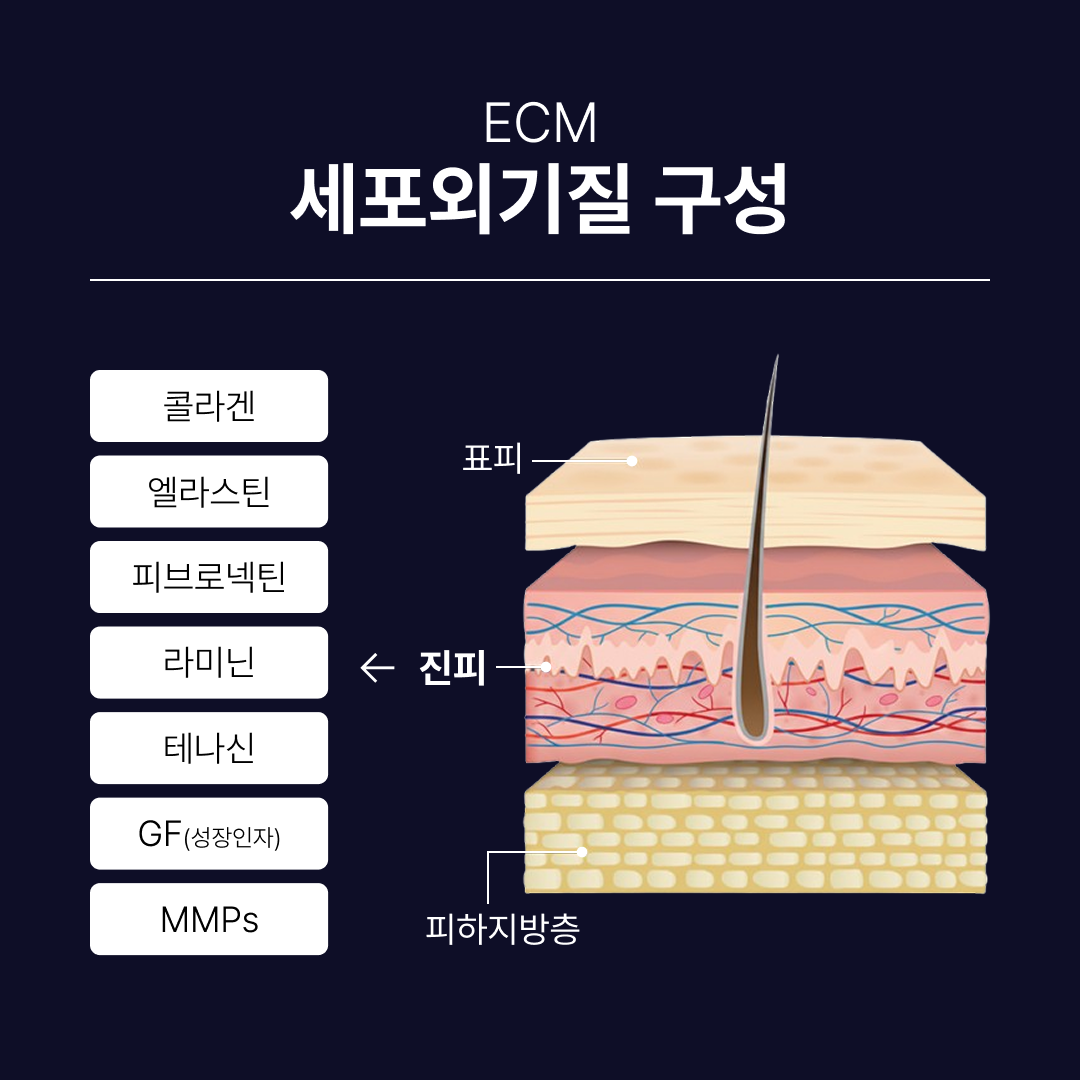 리투오눈밑 ECM 구성.png