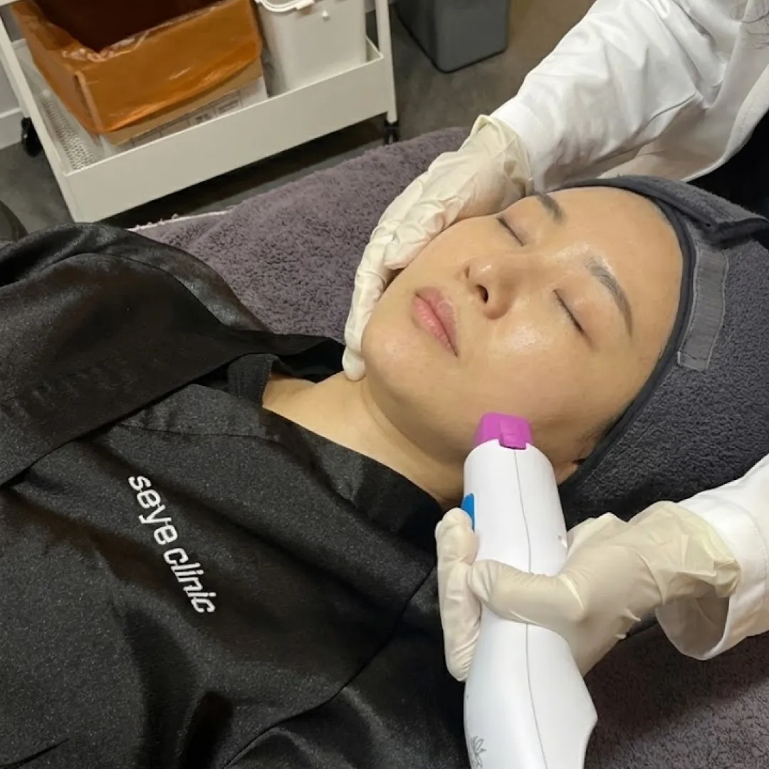 써마지 효과 후기-1.webp