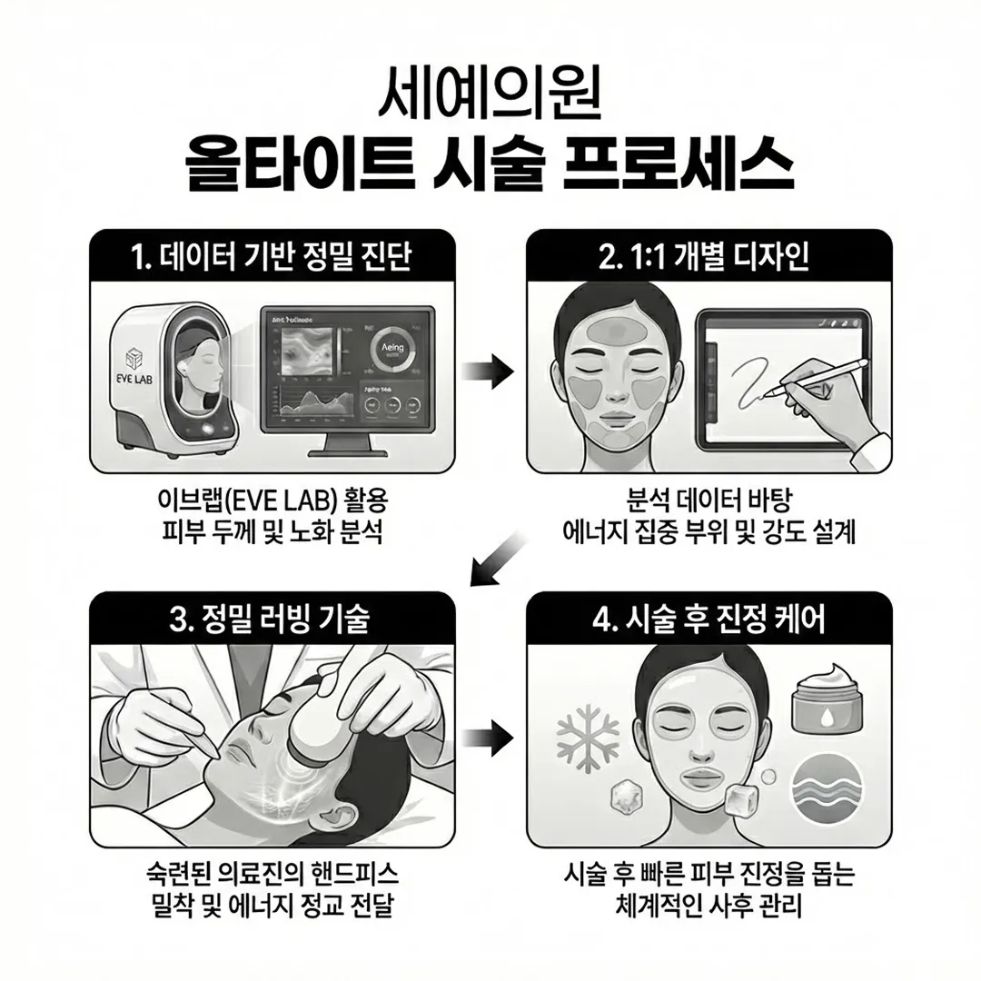 올타이트 시술 방식.webp