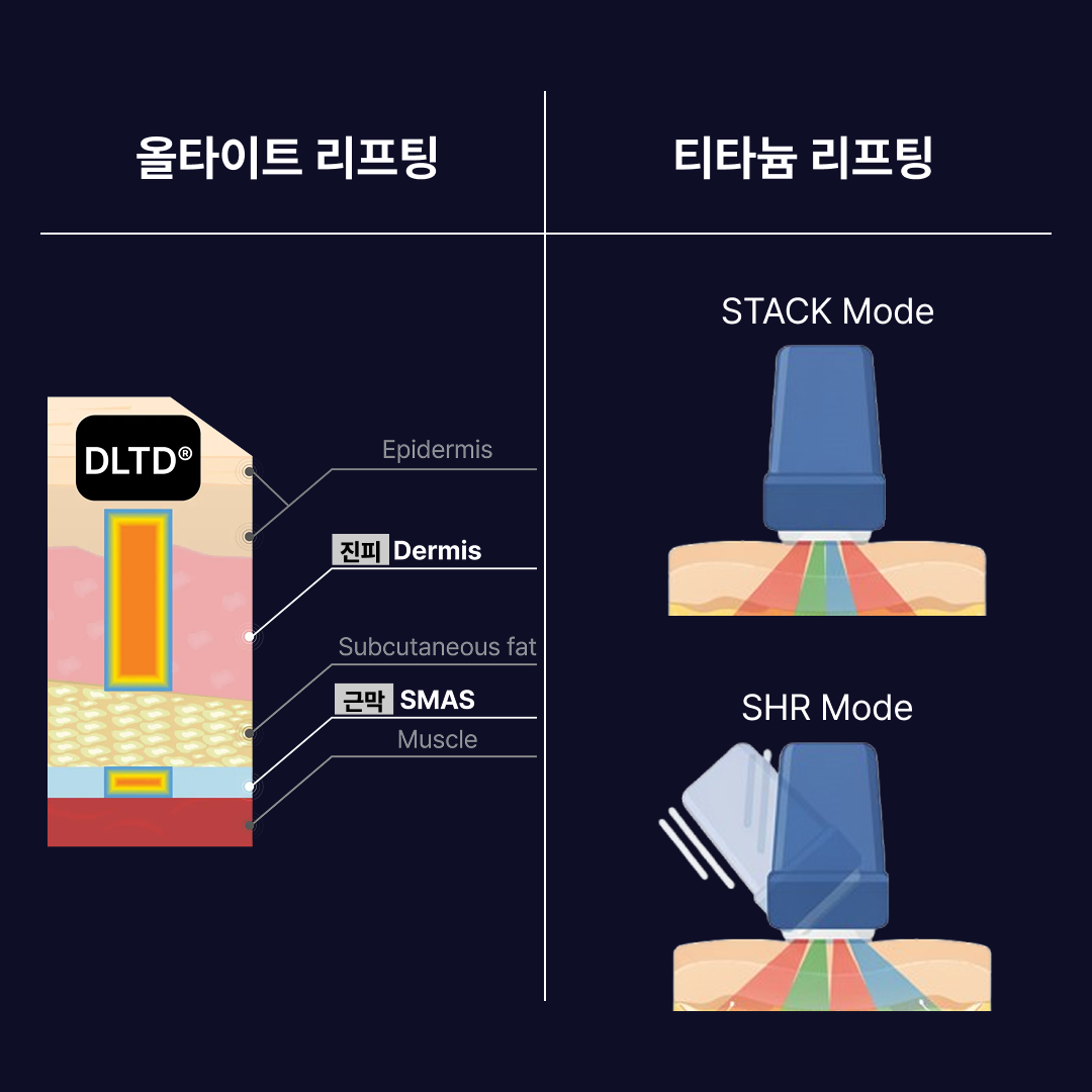 올타이트 티타늄 원리 비교.png