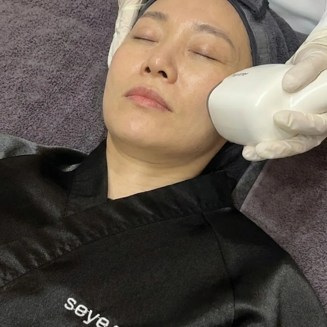 올타이트 효과.webp