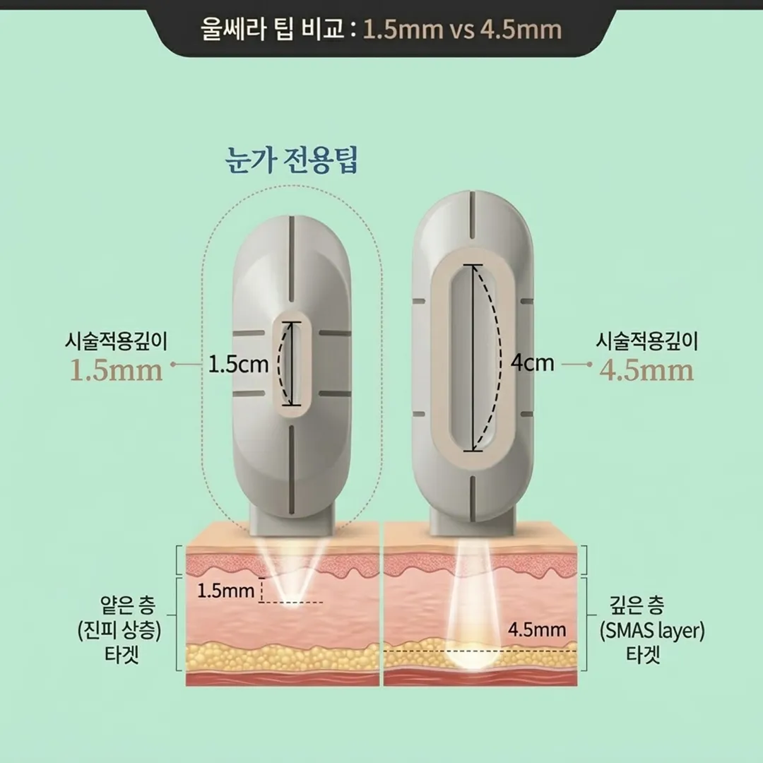 울쎄라 팁 비교-4.webp