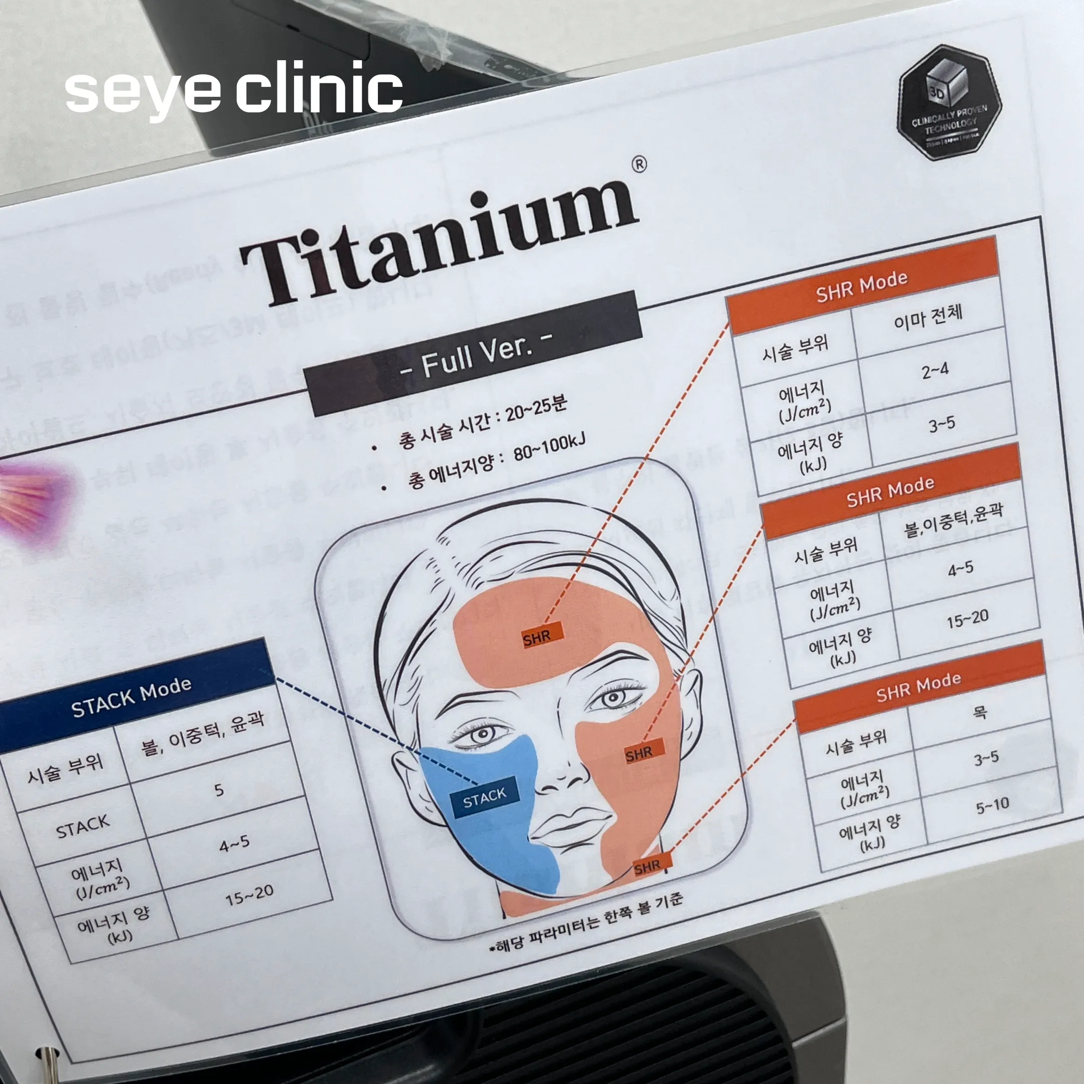 티타늄리프팅 부위.webp