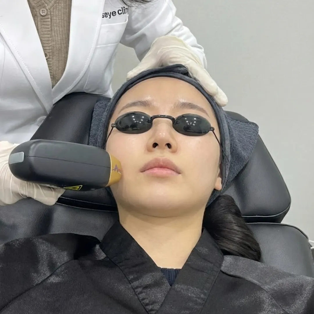 티타늄리프팅 후기 병원.webp