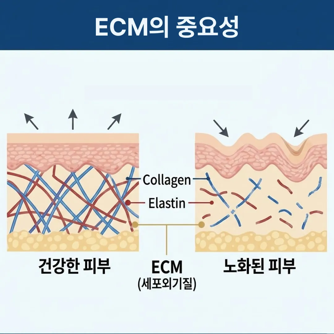 ECM 스킨부스터 역할.webp